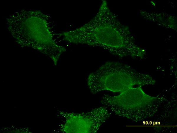 Immunofluorescence of monoclonal antibody to ALDH9A1 on HeLa cell . [antibody concentration 10 ug/ml]