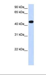 Transfected 293T cell lysate. Antibody concentration: 1.0 ug/ml. Gel concentration: 12%.