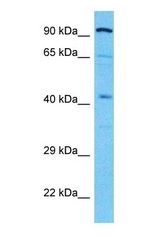 Western blot of ALDOB Antibody with human 721_B Whole Cell lysate.
