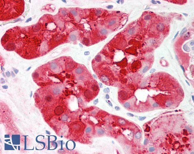 Human Kidney: Formalin-Fixed, Paraffin-Embedded (FFPE)