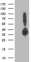 HEK293T cells were transfected with the pCMV6-ENTRY control (Left lane) or pCMV6-ENTRY ALDOB (Right lane) cDNA for 48 hrs and lysed. Equivalent amounts of cell lysates (5 ug per lane) were separated by SDS-PAGE and immunoblotted with anti-ALDOB.