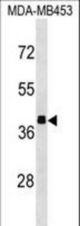 ALDOB Antibody western blot of MDA-MB453 cell line lysates (35 ug/lane). The ALDOB antibody detected the ALDOB protein (arrow).