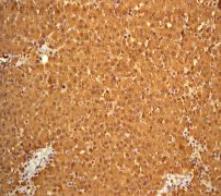 IHC of paraffin-embedded human liver tissue using anti-Aldolase B antibody (LS-C105443).