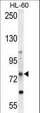 ABCD1 Antibody western blot of HL-60 cell line lysates (35 ug/lane). The ABCD1 antibody detected the ABCD1 protein (arrow).