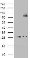 HEK293T cells were transfected with the pCMV6-ENTRY control (Left lane) or pCMV6-ENTRY ABCD1 (Right lane) cDNA for 48 hrs and lysed. Equivalent amounts of cell lysates (5 ug per lane) were separated by SDS-PAGE and immunoblotted with anti-ABCD1.