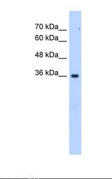 Jurkat cell lysate. Antibody concentration: 2.5 ug/ml. Gel concentration: 12%.