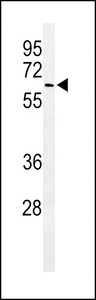 Western blot of ALG10 Antibody in A375 cell line lysates (35 ug/lane). ALG10 (arrow) was detected using the purified antibody.