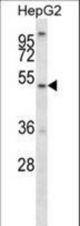 ALG11 Antibody western blot of HepG2 cell line lysates (35 ug/lane). The ALG11 antibody detected the ALG11 protein (arrow).
