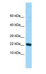ALG13 antibody Western Blot of Fetal Stomach.