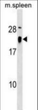 ALG13 Antibody western blot of mouse spleen tissue lysates (35 ug/lane). The ALG13 antibody detected the ALG13 protein (arrow).