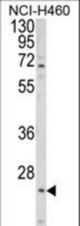 Western blot of ALG14 Antibody in NCI-H460 cell line lysates (35 ug/lane). ALG14 (arrow) was detected using the purified antibody.
