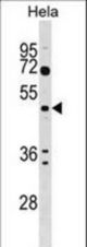 ALG2 Antibody western blot of HeLa cell line lysates (35 ug/lane). The ALG2 antibody detected the ALG2 protein (arrow).
