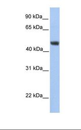 HepG2 cell lysate. Antibody concentration: 1.0 ug/ml. Gel concentration: 12%.