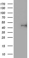 HEK293T cells were transfected with the pCMV6-ENTRY control (Left lane) or pCMV6-ENTRY ALG2 (Right lane) cDNA for 48 hrs and lysed. Equivalent amounts of cell lysates (5 ug per lane) were separated by SDS-PAGE and immunoblotted with anti-ALG2.