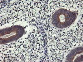 IHC of paraffin-embedded Human endometrium tissue using anti-ALG2 mouse monoclonal antibody.