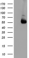 HEK293T cells were transfected with the pCMV6-ENTRY control (Left lane) or pCMV6-ENTRY ALG2 (Right lane) cDNA for 48 hrs and lysed. Equivalent amounts of cell lysates (5 ug per lane) were separated by SDS-PAGE and immunoblotted with anti-ALG2.