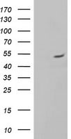 HEK293T cells were transfected with the pCMV6-ENTRY control (Left lane) or pCMV6-ENTRY ALG2 (Right lane) cDNA for 48 hrs and lysed. Equivalent amounts of cell lysates (5 ug per lane) were separated by SDS-PAGE and immunoblotted with anti-ALG2.