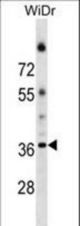ALG5 Antibody western blot of WiDr cell line lysates (35 ug/lane). The ALG5 antibody detected the ALG5 protein (arrow).