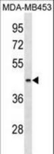 ALG8 Antibody western blot of MDA-MB453 cell line lysates (35 ug/lane). The ALG8 antibody detected the ALG8 protein (arrow).