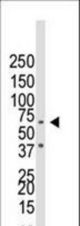 Western blot of anti-BMPR1B antibody in NCI-H460 cell lysate. BMPR1B (arrow) was detected using purified antibody. Secondary HRP-anti-rabbit was used for signal visualization with chemiluminescence.