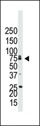 Western blot of anti-BMPR1B antibody in NCI-H460 cell lysate. BMPR1B (arrow) was detected using purified antibody. Secondary HRP-anti-rabbit was used for signal visualization with chemiluminescence.