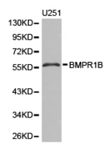 Western blot of extracts of U251 cell lines, using BMPR1B antibody.