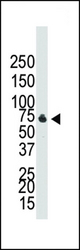 Western blot of anti-BMPR1B antibody in NCI-H460 cell lysate. BMPR1B (arrow) was detected using purified antibody. Secondary HRP-anti-rabbit was used for signal visualization with chemiluminescence.