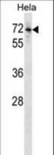 Mouse Bmpr1b Antibody western blot of HeLa cell line lysates (35 ug/lane). The Bmpr1b antibody detected the Bmpr1b protein (arrow).