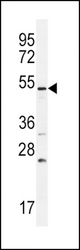 BMPR1B Antibody western blot of U251 cell line lysates (35 ug/lane). The BMPR1B antibody detected the BMPR1B protein (arrow).