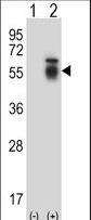 Western blot of ACVR1 (arrow) using rabbit polyclonal ACVR1 Antibody. 293 cell lysates (2 ug/lane) either nontransfected (Lane 1) or transiently transfected (Lane 2) with the ACVR1 gene.