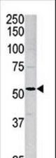 Western blot of anti-ACVR1 antibody in mouse brain tissue lysate. ACVR1(arrow) was detected using the purified antibody.