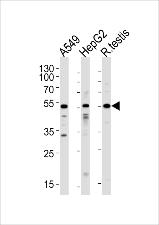 Western blot of lysates from A549,HepG2 cell line and rat testis tissue (from left to right),using ACVR1 Antibody. Antibody was diluted at 1:1000 at each lane. A goat anti-rabbit IgG H&L (HRP) at 1:5000 dilution was used as the secondary antibody.Lysates at 35ug per lane.