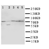 WB of ABCG1 antibody. Lane 1: U87 Cell Lysate. Lane 2: SMMC Cell Lysate. Lane 3: HELA Cell Lysate. Lane 4: COLO320 Cell Lysate. Lane 5: MCF-7 Cell Lysate.