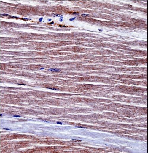 Mouse Acvr1 Antibody immunohistochemistry of formalin-fixed and paraffin-embedded mouse skeletal muscle followed by peroxidase-conjugated secondary antibody and DAB staining.