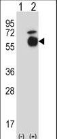 Western blot of Acvr1 (arrow) using rabbit polyclonal Mouse Acvr1 Antibody. 293 cell lysates (2 ug/lane) either nontransfected (Lane 1) or transiently transfected (Lane 2) with the Acvr1 gene.