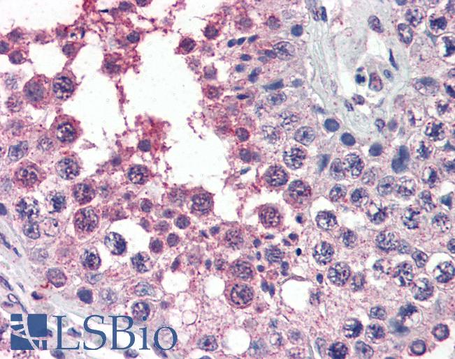 Anti-ACVR1 antibody IHC of human testis. Immunohistochemistry of formalin-fixed, paraffin-embedded tissue after heat-induced antigen retrieval. Antibody LS-B3020 concentration 4 ug/ml.