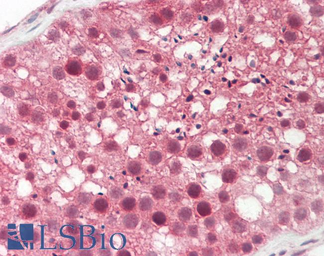 Human Testis: Formalin-Fixed, Paraffin-Embedded (FFPE)