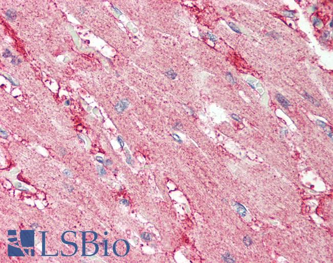 Human Heart: Formalin-Fixed, Paraffin-Embedded (FFPE)