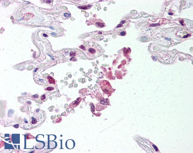 Anti-ABCG1 antibody IHC of human lung. Immunohistochemistry of formalin-fixed, paraffin-embedded tissue after heat-induced antigen retrieval. Antibody LS-B507 concentration 20 ug/ml.