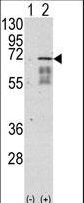 Western blot of ACVR1 (arrow) using rabbit polyclonal ACVR1 Antibody (Center N153). 293 cell lysates (2 ug/lane) either nontransfected (Lane 1) or transiently transfected with the ACVR1 gene (Lane 2) (Origene Technologies).