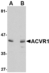 Western blot of ACVR1 in A549 cell lysate with ACVR1 antibody at 1 ug/ml in (A) the absence and (B) the presence of blocking peptide.