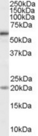 Antibody (1 ug/ml) staining of HeLa cell lysate (35 ug protein in RIPA buffer). Primary incubation was 1 hour. Detected by chemiluminescence.
