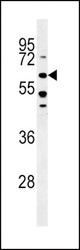 BMPR1A -C180 western blot of HeLa cell line lysates (35 ug/lane). The BMPR1A antibody detected the BMPR1A protein (arrow).