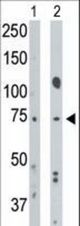 The anti-BMPR1A antibody is used in Western blot to detect BMPR1A in mouse muscle tissue lysate (Lane 1) and HeLa cell lysate (Lane 2).
