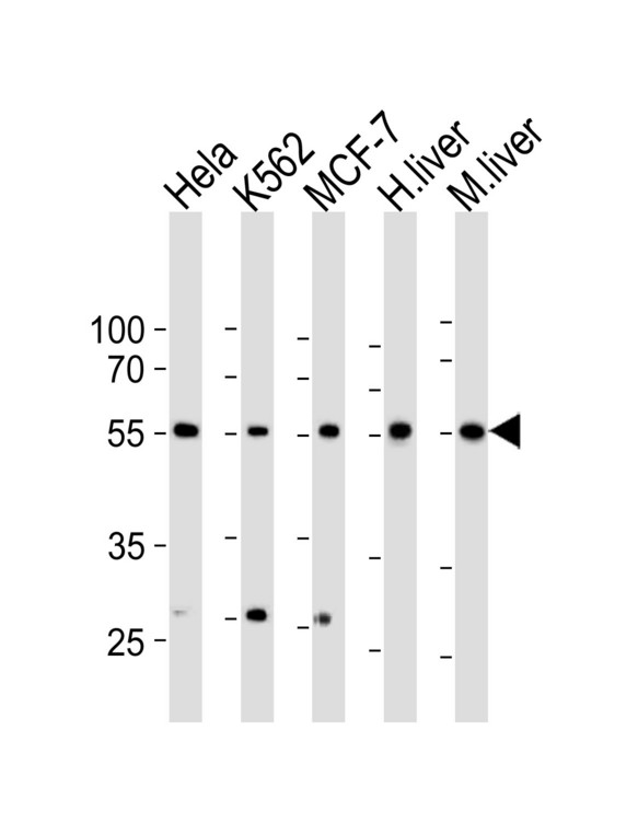 Western blot of lysates from HeLa, K562, MCF-7 cell line, human liver, mouse liver tissue lysate(from left to right), using BMPR1A Antibody(A13). Antibody was diluted at 1:1000 at each lane. A goat anti-rabbit IgG H&L (HRP) at 1:10000 dilution was used as the secondary antibody. Lysates at 35ug per lane.