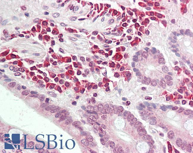 Anti-ALK3 / BMPR1A antibody IHC staining of human small intestine. Immunohistochemistry of formalin-fixed, paraffin-embedded tissue after heat-induced antigen retrieval. Antibody LS-B9804 dilution 1:100.