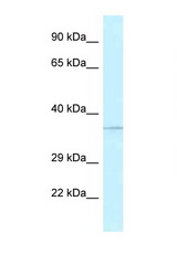 ALKBH1 / ALKBH antibody LS-C145568 Western blot of Fetal Kidney lysate. Antibody concentration 1 ug/ml.