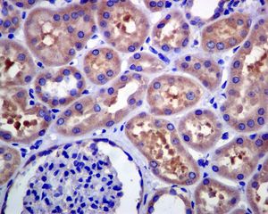IHC of paraffin-embedded human kidney tissue using anti-ALKBH antibody.