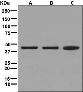 Western blot analysis on (A) Jurkat, (B) K562, and (C) A549 cell lysates using anti-ALKBH antibody.