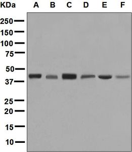Western blot analysis on (A) A431, (B) Jurkat, (C) A549, (D) K562, (E) Raw 264.7, and (F) NIH/3T3 cell lysates using anti-ALKBH antibody.